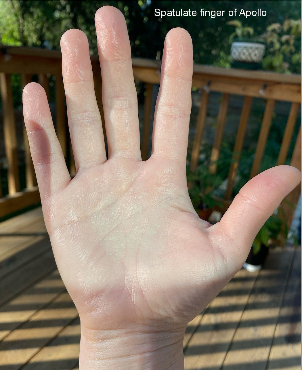 Fingertip shapes and what they mean in palmistry – Sister Palm ...